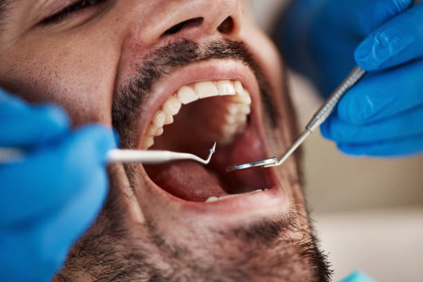Best Mobile Emergency Dentist in Merrick, NY